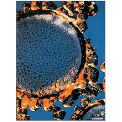 AQUATECTOR® - Mikrofloat®